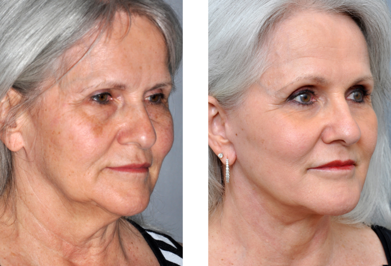 How The ‘lunchtime Face Lift Can Benefit Your Daily Routine
