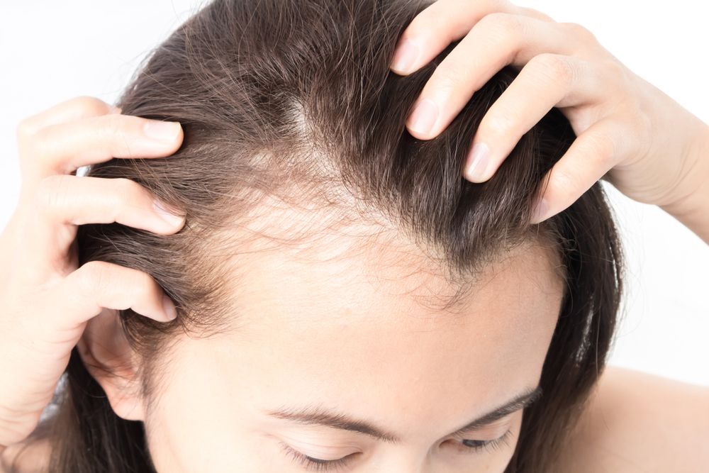 Why Does Weight Loss Cause Hair Loss? A Short Guide